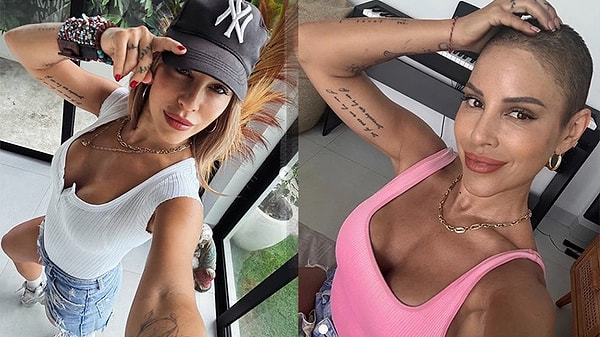 Irmak Ünal’ın Hastalığı Ne?