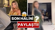 Son Halini Paylaştı: Cinsiyet Geçiş Sürecini Tamamlayan Mika Raun Bu Sefer de Poposunu Yaptırdı!
