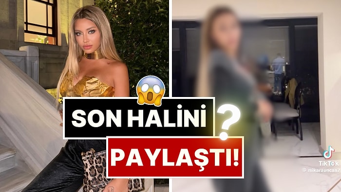 Son Halini Paylaştı: Cinsiyet Geçiş Sürecini Tamamlayan Mika Raun Bu Sefer de Poposunu Yaptırdı!