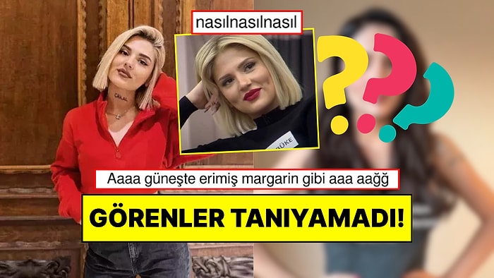 Görenler İnanamadı: Eski Kısmetse Olur Yarışmacısı Dolgularını Eritince Değişimi Gündem Oldu