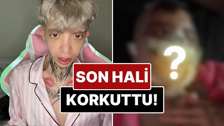 Eleştiriler Sonrası Yüzüne Birçok Estetik İşlem Yaptıran 'Tablet Reis'in Son Hali Görenleri Korkuttu!