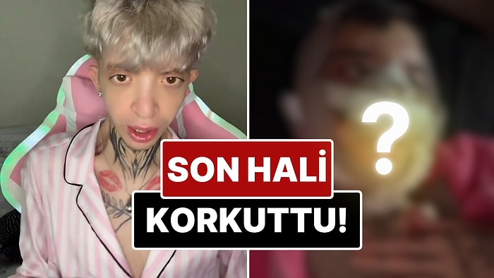 Eleştiriler Sonrası Yüzüne Birçok Estetik İşlem Yaptıran 'Tablet Reis'in Son Hali Görenleri Korkuttu!