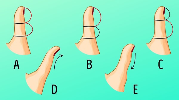 Which of these does your thumb resemble the most?