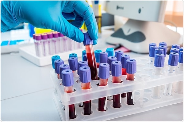 Additionally, analyses conducted on a second sample of 10,000 individuals revealed that the education levels of individuals with the AB blood group are also above the general average.