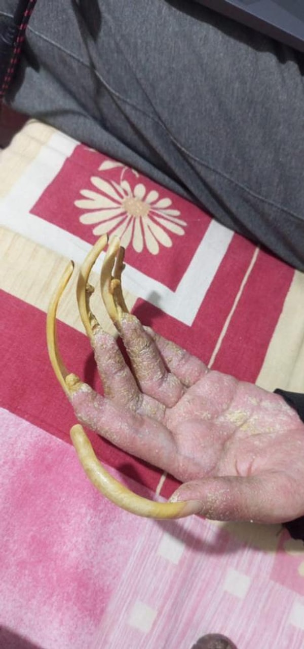 "Hiçbir şey yapmak istemediğim için banyo da yapmak istemiyorum, elimde olsa tuvalete de gitmem ve yemek de yemem ve onları mecbur olduğum için yapıyorum."