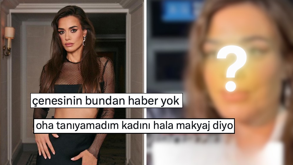 Estetik İddialarını Yalanlayan Bensu Soral'ın Kameraya Yansıyan Yüz Hatları İnandırıcılığını Sorgulattı!