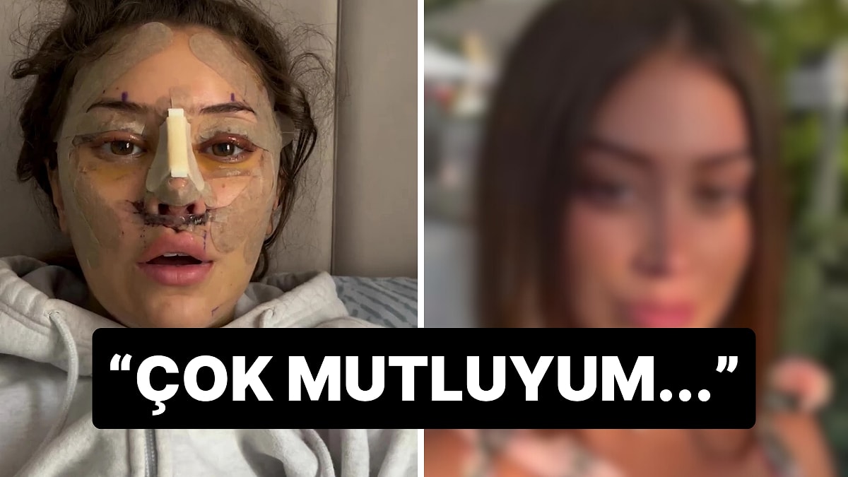 28 Yaşında Türkiye’de Yüz Germe Yaptıran Turistin Son Hali Gündem Oldu: “En İyi Versiyonum Oldum”