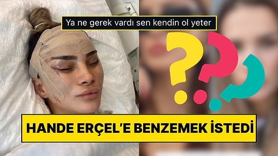 Hande Erçel’e Benzemek İçin Estetik Operasyon Geçiren Kadın Sonucu Görünce Kendini Başka Ünlüye Benzetti