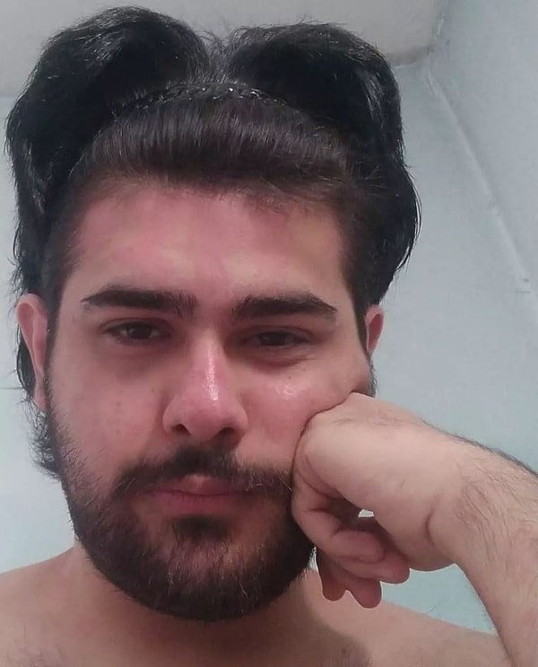 Eski hali ortaya çıktı: Uzmanlar "ağır depresyon" diyor.
