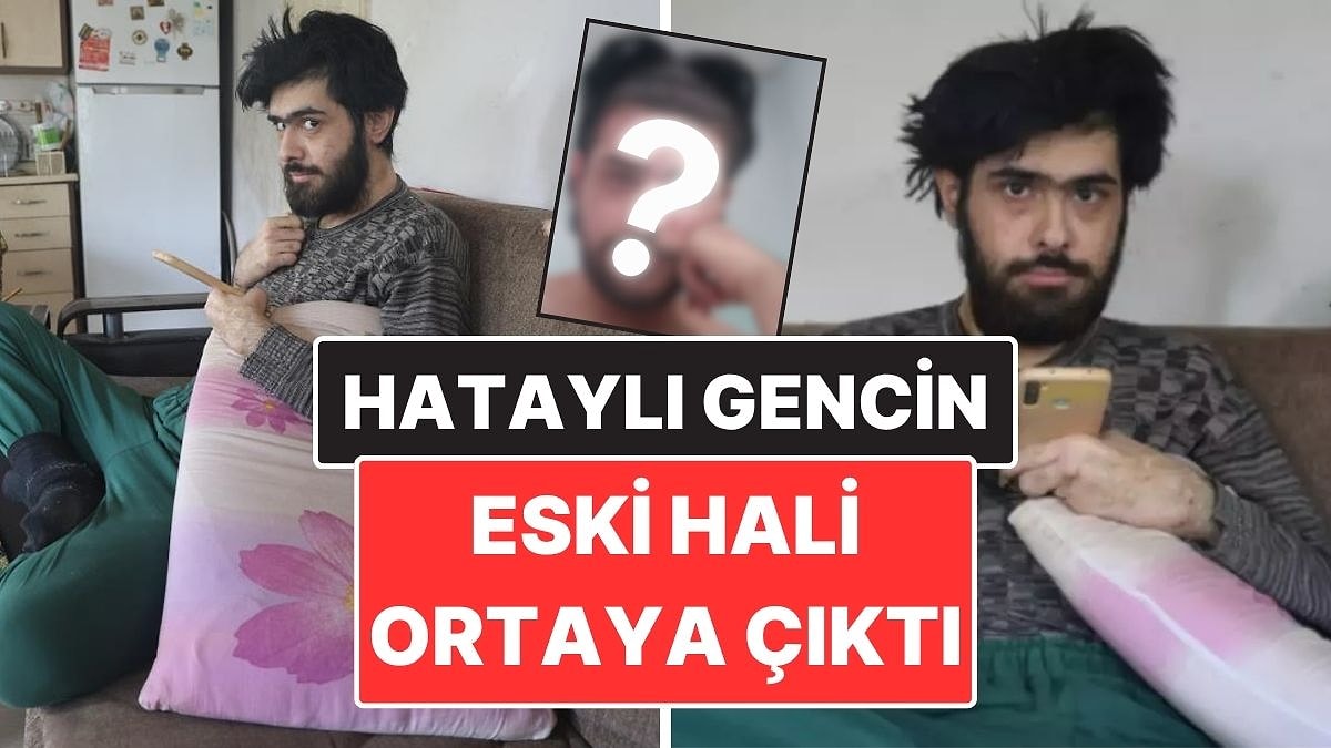 3 Yıldır Duş Almayan Hataylı Gencin Eski Hali Ortaya Çıktı