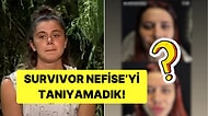 Estetik Yaptırmış! Survivor Nefise Karatay'ın Dudak Dolgusu Gündem Oldu