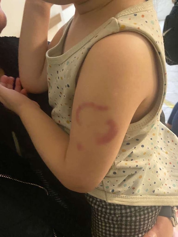 Edirne’de özel bir kreşte eğitim gören 3 yaşındaki çocuğun ailesi polise giderek şikayetçi oldu.