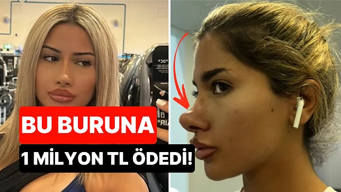 Yaklaşık 1 Milyon TL Ödedi: Burun Estetiği Yüzünden Michael Jackson'a Benzetilen Kadın İsyan Etti
