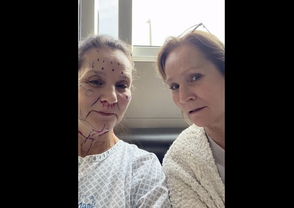 She suddenly looks 30 years younger. But, are these simultaneous operations dangerous?