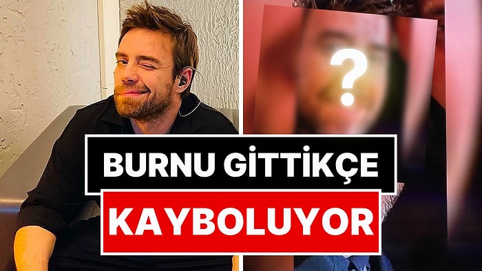 Artık Bitti Sanıyorduk: Burnuyla Derdi Bitmeyen Murat Dalkılıç'ın 12. Kez Ameliyat Olduğu Ortaya Çıktı!