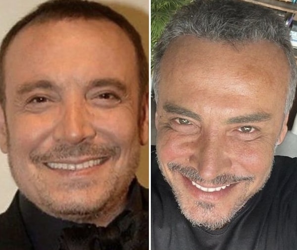 This "aging" issue seems to have really bothered Cenk Eren, messed with his nerves so much that we watched in astonishment at what Cenk Eren had done to himself two years later!