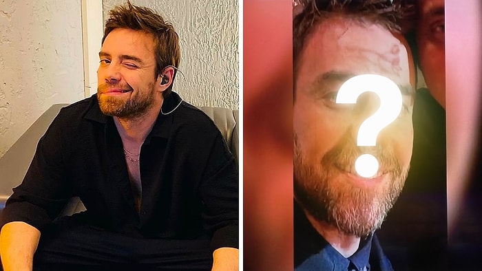 Not Over Yet: Murat Dalkılıç Reportedly on Nose Surgery No. 12