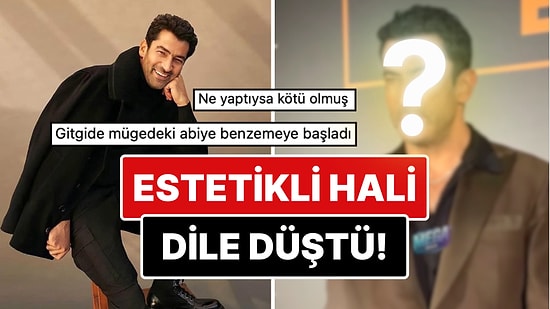 Son Haliyle Dikkat Çeken Kenan İmirzalıoğlu'nun Yüzüne Yaptırdığı Estetik İşlemler Göze Battı!