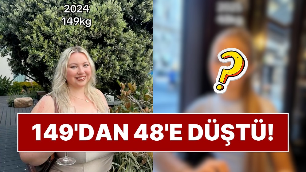 Bir Yıl İçinde 101 Kilo Veren Kadının Değişimi Gündem Oldu!
