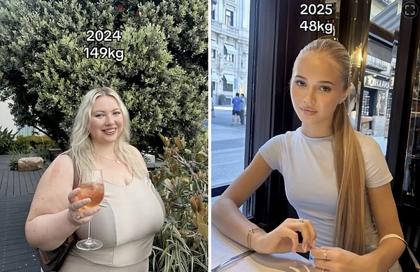Bir kadının 149 kilo ve 48 kilo olan halleri paylaşıldı.
