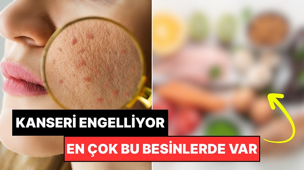 Uzmanlar Açıkladı: Cilt Kanseri Riskini Yarı Yarıya Azaltan O Vitamin
