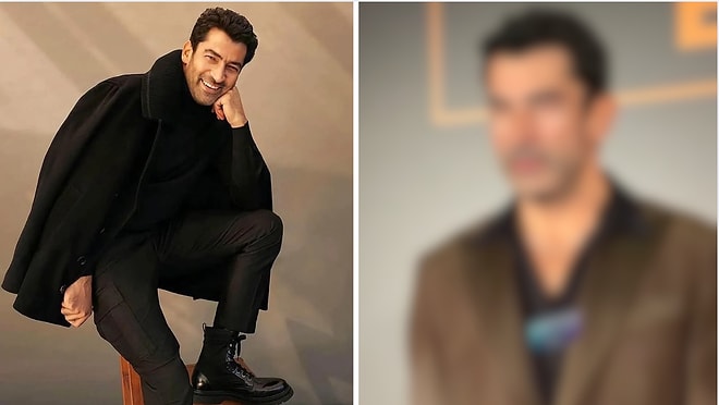 Kenan İmirzalıoğlu’s Latest Look Draws Attention and Fuels Allegations of Aesthetic Surgery!