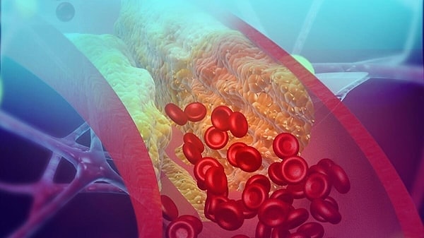 "One of the most comprehensive studies ever conducted to date."