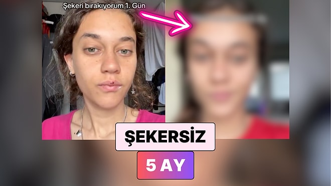 Şekeri Hayatından Tamamen Çıkaran Kadın 5 Ayda Yaşadığı Değişimi Paylaştı