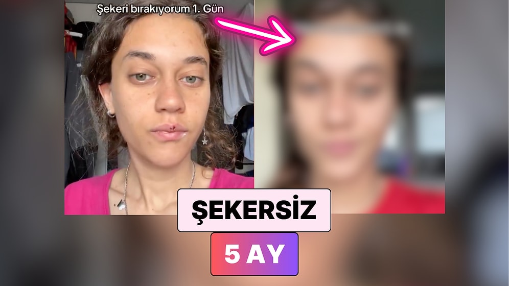 Şekeri Hayatından Tamamen Çıkaran Kadın 5 Ayda Yaşadığı Değişimi Paylaştı