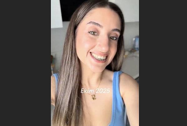 14 ayda neredeyse tamamen düzelmiş.