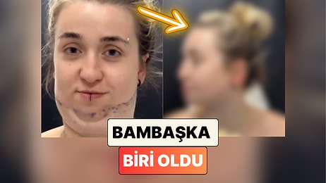Geçirdiği Gıdı Operasyonunun Ardından Bambaşka Birine Dönüşen Kadının İnanılmaz Değişimi