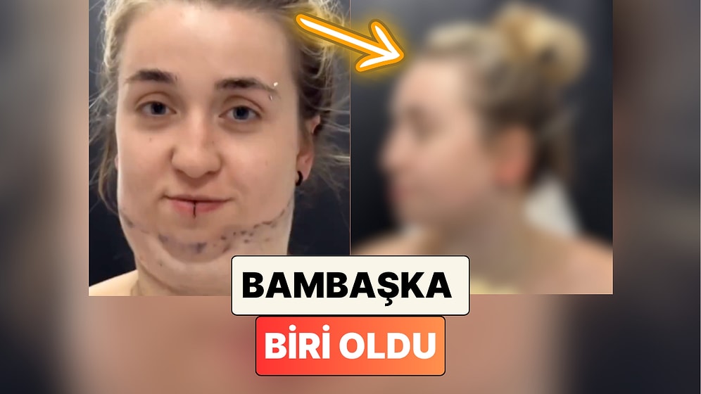 Geçirdiği Gıdı Operasyonunun Ardından Bambaşka Birine Dönüşen Kadının İnanılmaz Değişimi