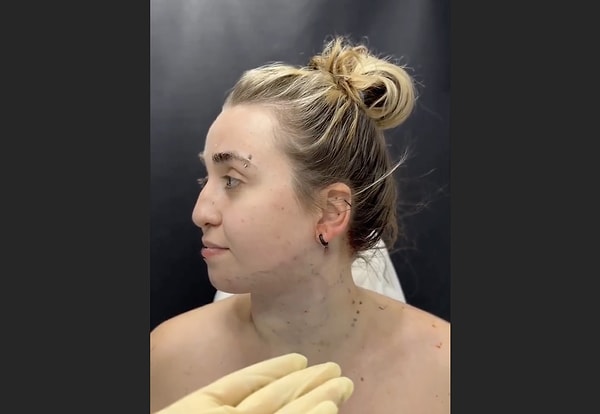 Looking at your phone for extended periods can lead to sagging skin on the neck.