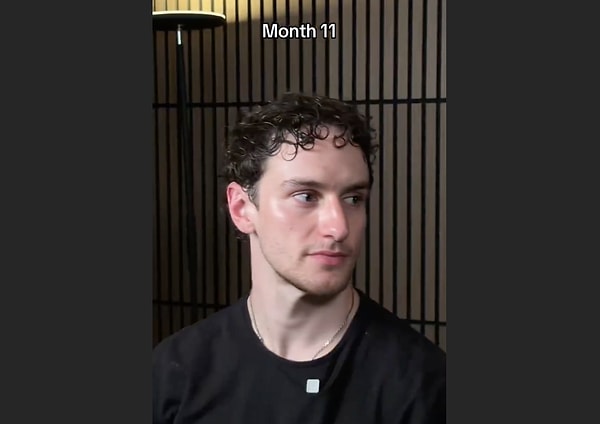 How is hair transplantation performed? Is it safe?