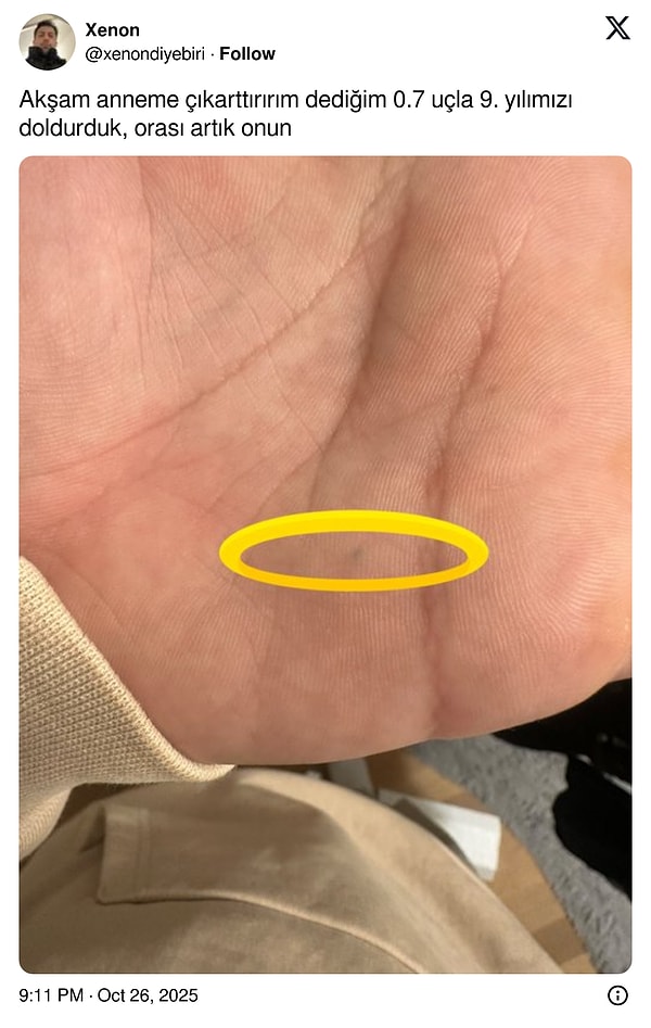 Kurşun yarası mı bu?