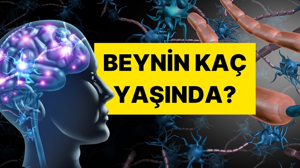 Bu 5 Sorudan En Az 3’üne “Evet” Diyorsanız Beyniniz Oldukça Yaşlı