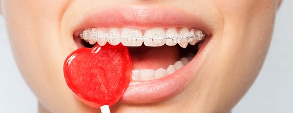 5. Şekerli ve asidik yiyeceklerden kaçın.