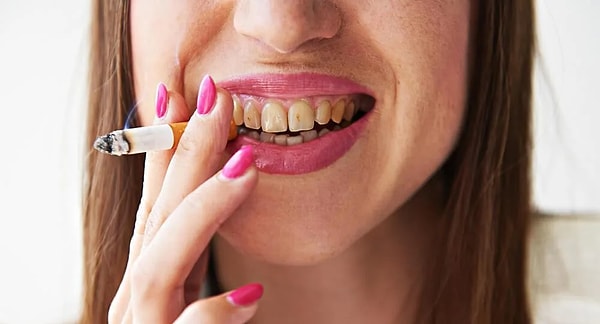 5. “Sigara içsem de beyazlatma yaptırırsam sorun olmaz.”