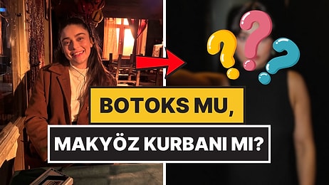 Botoks mu Makyöz Kurbanı mı? Ayça Ayşin Turan'ın Yüz Hatları Fena Göze Battı!