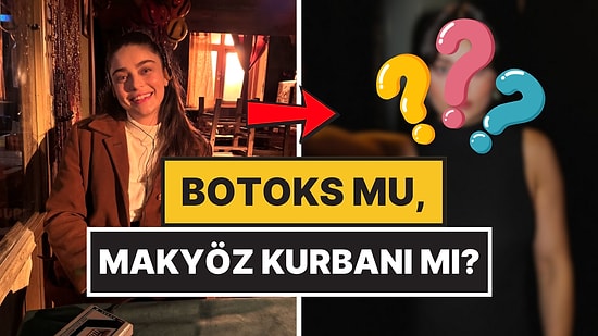 Botoks mu Makyöz Kurbanı mı? Ayça Ayşin Turan'ın Yüz Hatları Fena Göze Battı!