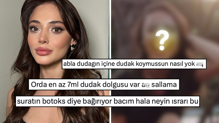 Eski Fotoğrafları Yeniden Dolaşıma Girdi: Estetik İşlemleri Yalanlamakta Israrcı Olan Rabia Soytürk Dile Düştü