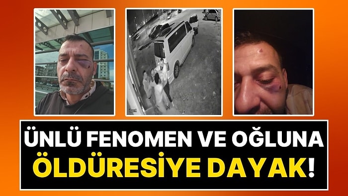 Sosyal Medya Fenomeni, 13 Yaşındaki Oğlu ve Kardeşi, Boşanma Aşamasındaki Eşi ve Ailesi Tarafından Darbedildi