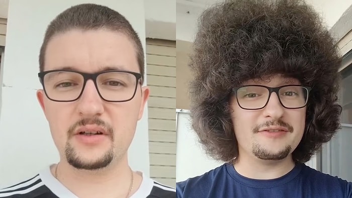 Bir Manchester United Taraftarı Üst Üste 5 Galibiyet Alana Kadar Saçlarını Kesmeme Sözü Verdi