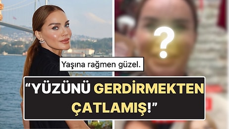 Ebru Şallı'nın Filtresiz ve Photoshopsuz Hali Ortaya Çıktı: Yüzünün Son Hali Tartışma Yarattı!