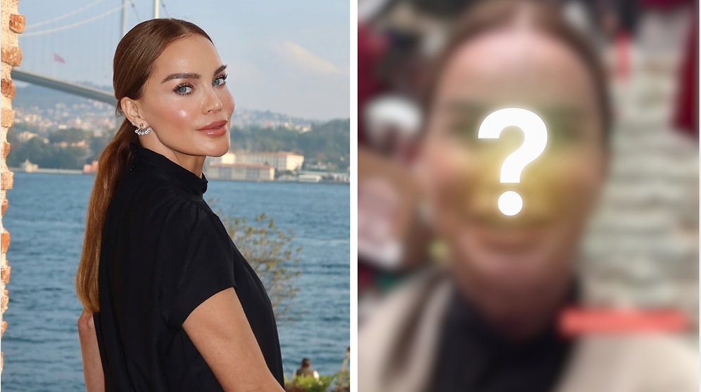 Ebru Şallı’s Unedited, Unfiltered Face Revealed: Her Latest Look Sparked Debate!