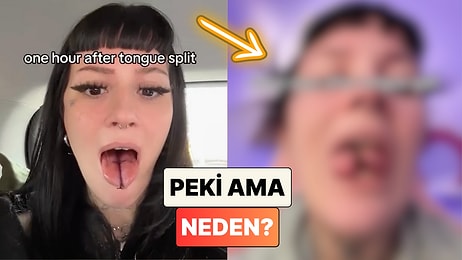 Dilini İkiye Böldüren Kadın İyileşme Sürecinde Yaşadıklarını Paylaştı