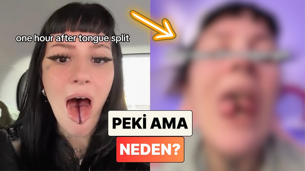 Dilini İkiye Böldüren Kadın İyileşme Sürecinde Yaşadıklarını Paylaştı