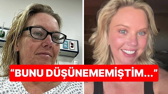 Tam Tamına 38 Kilo Verdi, Beklenmedik Yan Etki Yüzünden Estetik Operasyona Mahkum Oldu