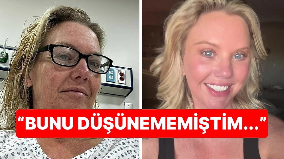 Tam Tamına 38 Kilo Verdi, Beklenmedik Yan Etki Yüzünden Estetik Operasyona Mahkum Oldu