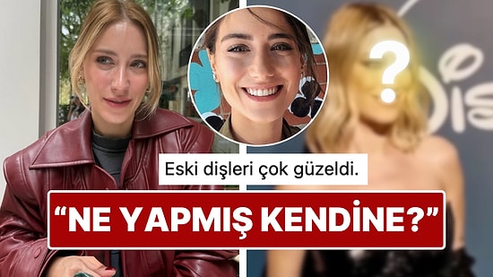 Yüzündeki Değişiklikle Son Hali Dikkat Çeken Hazal Kaya'nın Dişlerine Yaptırdığı İşlem Sınıfta Kaldı